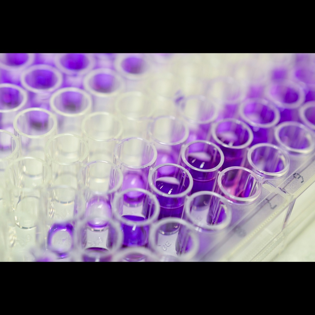 Human Mineralocorticoid Receptor ''NR3C2'' ELISA Assay   96 wells plate